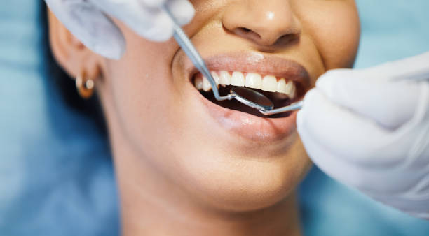Best Pediatric Emergency Dentist in Stansberry Lake, WA